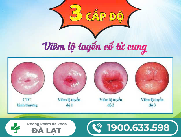 Hình ảnh minh họa